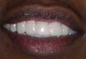 Family Dentist in Albany GA