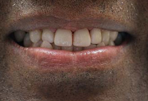 Albany GA Cosmetic Dentist