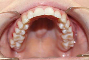 Family Dentist in Albany GA