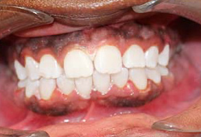 Family Dentist in Albany GA