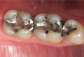 Emergency Dentist Albany GA