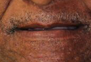 Dentist in Albany GA