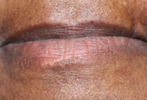 Albany GA Cosmetic Dentist