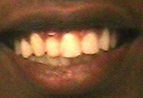 Sedation Dentist in Albany GA