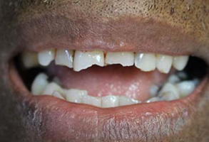 Dentist in Albany GA