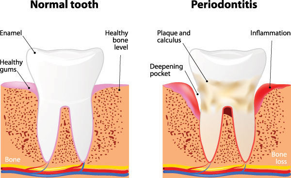 Mann Dental Care | Dental Cleanings, Implant Dentistry and Temporary Braces