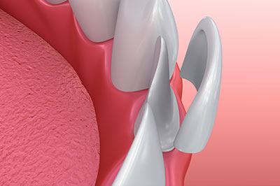 Mann Dental Care | CEREC, Dentures and Temporary Braces