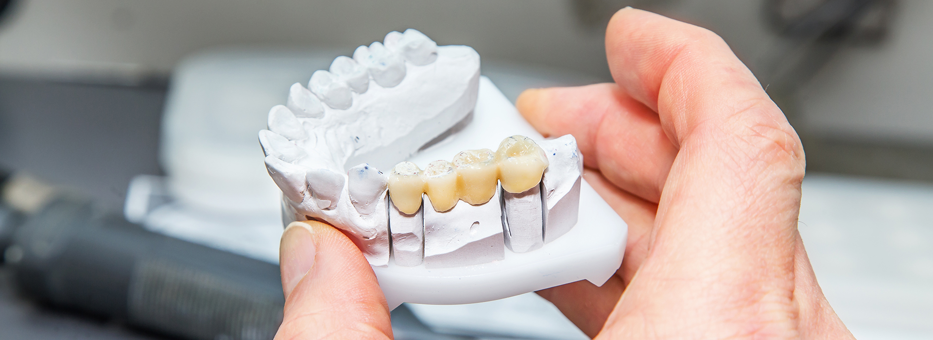 Mann Dental Care | Preventative Program, Root Canals and Pediatric Dentistry