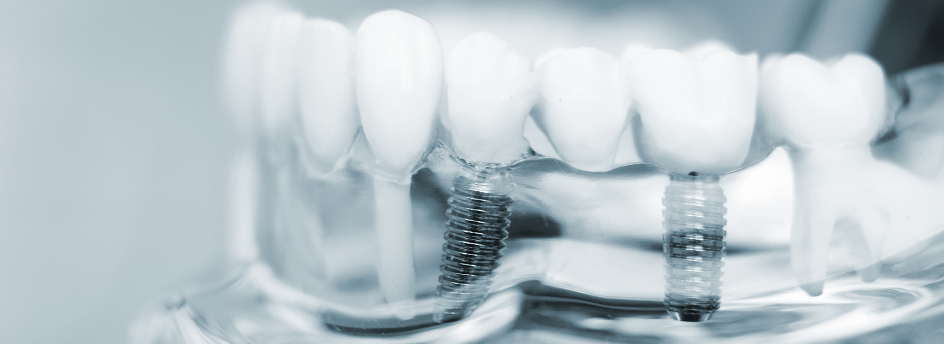 Mann Dental Care | Cosmetic Dentistry, Sedation Dentistry and Root Canals