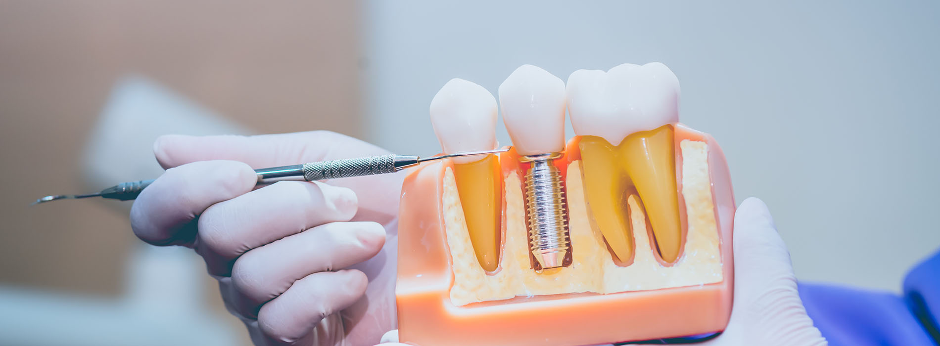 Mann Dental Care | Dental Bridges, Extractions and Dental Cleanings