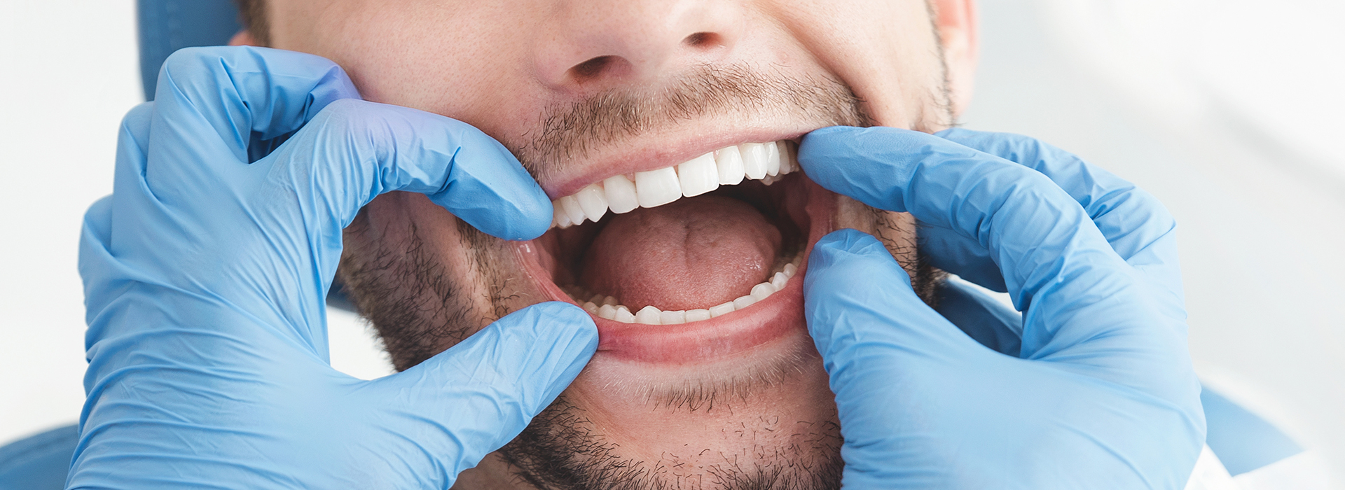 Mann Dental Care | Dental Fillings, Dental Cleanings and Dentures