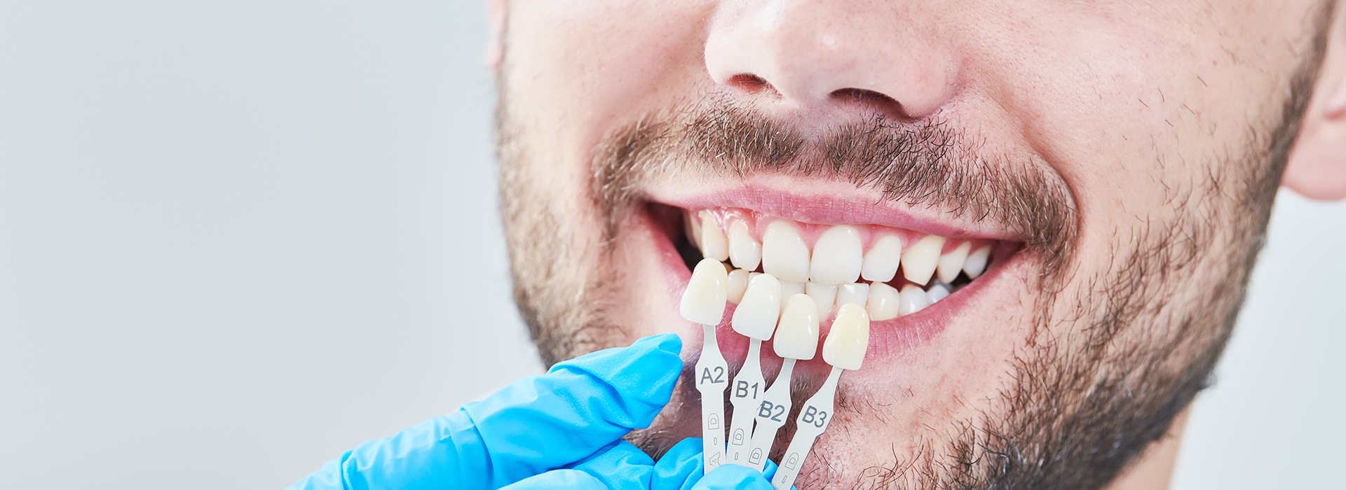 Mann Dental Care | Oral Cancer Screening, Dental Cleanings and Dental Bridges