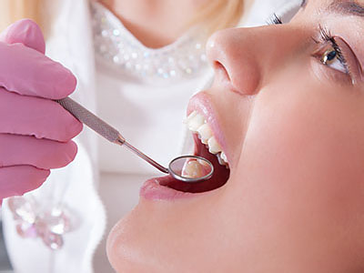 Mann Dental Care | Dental Cleanings, Crowns  amp  Caps and Emergency Treatment